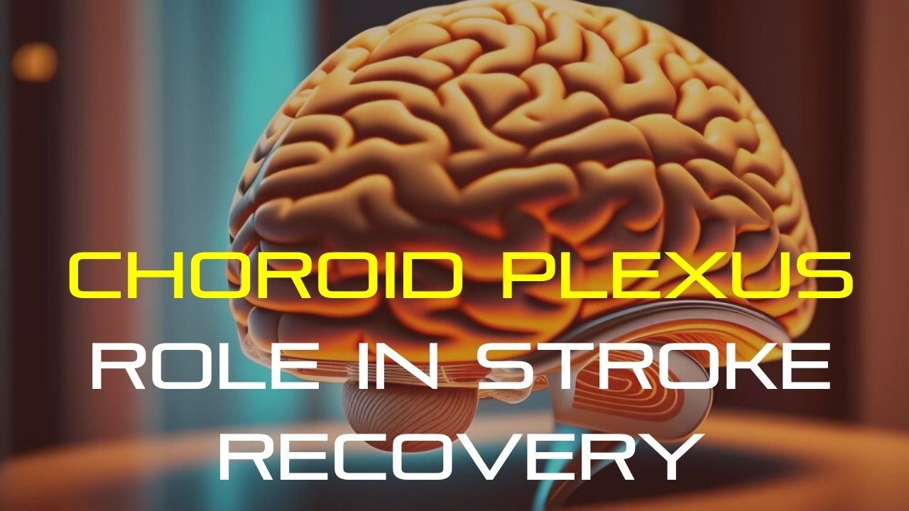 Choroid Plexus Role in Stroke Recovery